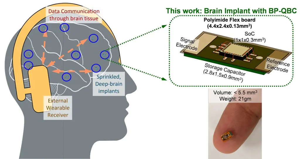 Wireless Brain Chip